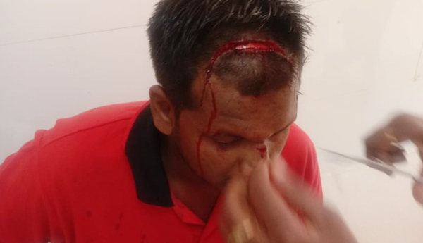 రోడ్డు ప్రమాదంలో యువకుడికి గాయాలు