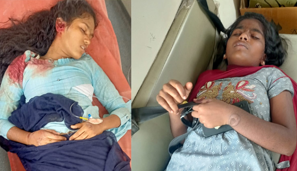 A-tipper-collided-with-a-scooty-Both-were-injured