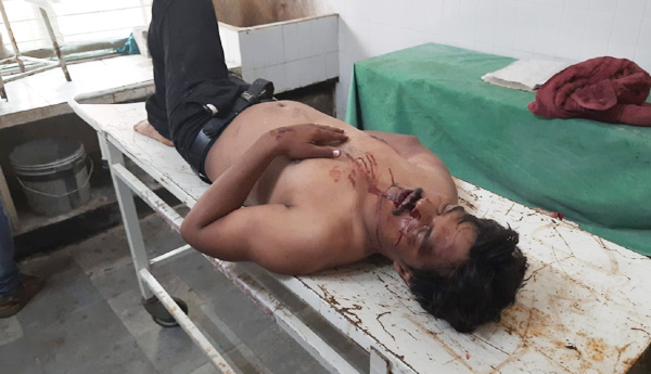 road-accident-in-gutti