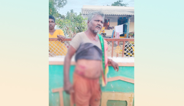 Farmer-seriously-injured-in-bear-attack