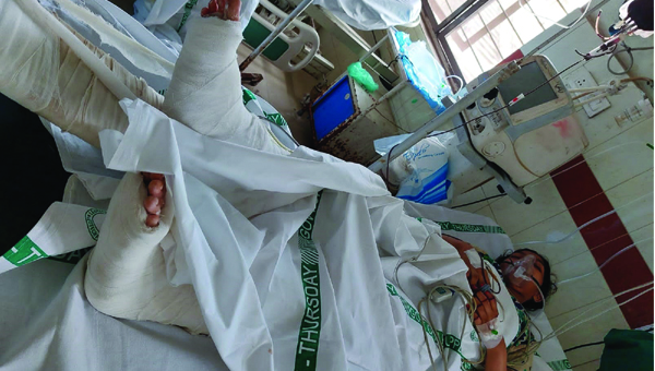 మేడ నుంచి పడి బాలికకు తీవ్ర గాయాలు