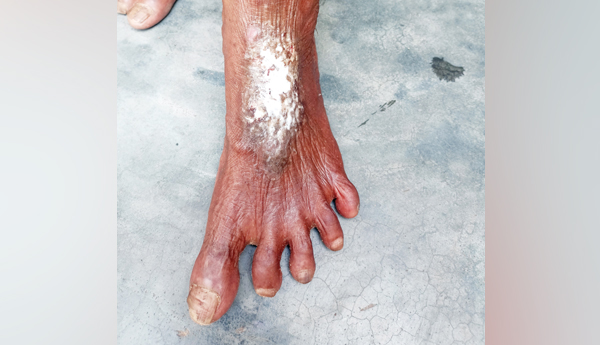 చీమల దండయాత్ర
