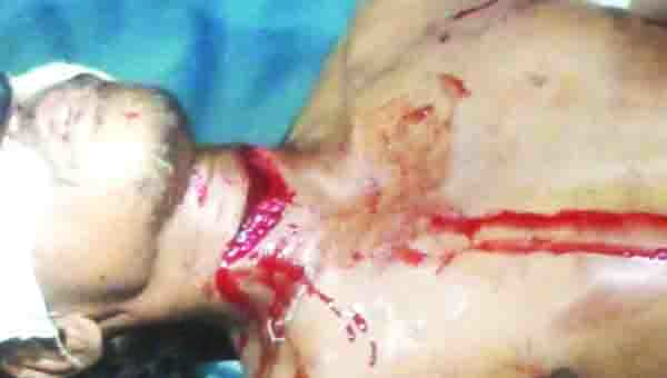 గొంతు కోసిన గుర్తు తెలియని వ్యక్తి