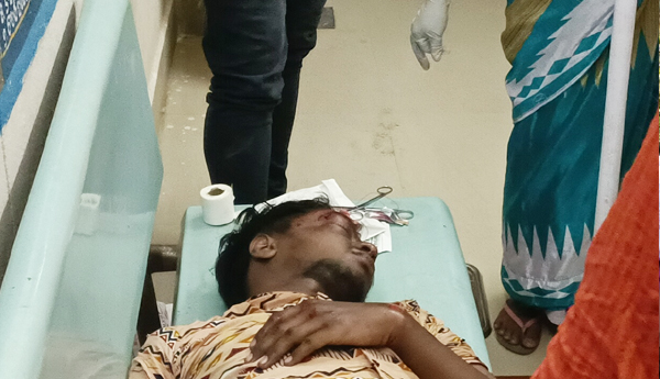 accident-in-rajavommangi