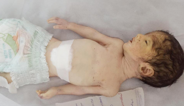 newborn-child-death-in-guntur