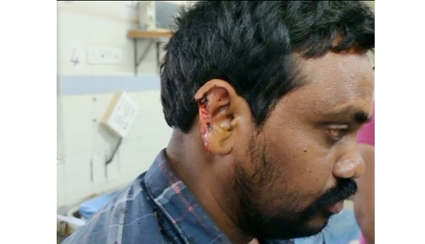 dispute-between-in-two-groups