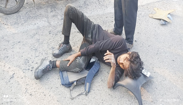 A-young-mans-leg-was-injured-in-a-road-accident