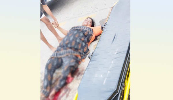 Car-hits-scooty- Woman-seriously-injured