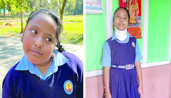 Let-the-girl-get-up-and-walk