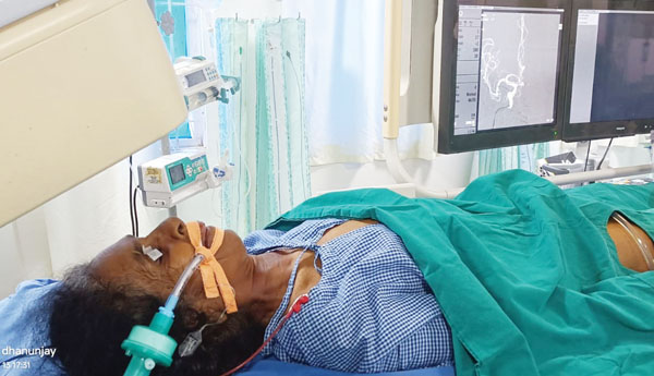 జెమ్స్‌లో ఎన్యూరిజం కాయిలింగ్‌ శస్త్రచికిత్స