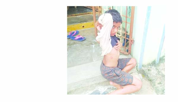 కోతి దాడిలో 12మందికి గాయాలు