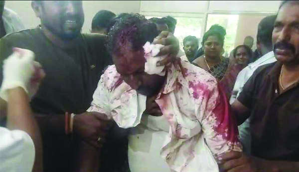 attack-on-news-reporter