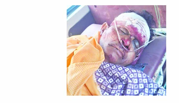 దంపతులను ఢకొీన్న ద్విచక్ర వాహనం