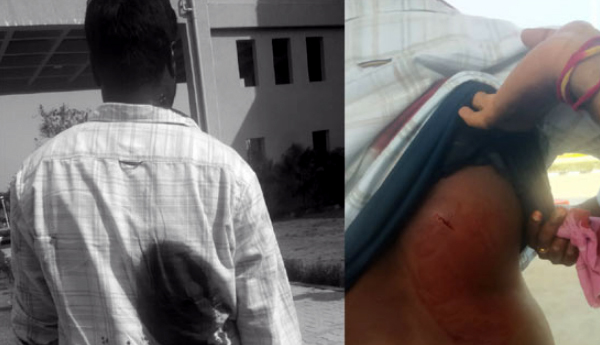 యాదాద్రి కలెక్టరేట్‌లో కత్తిపోటు కలకలం