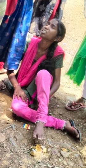 - విద్యార్థినికి గాయాలు