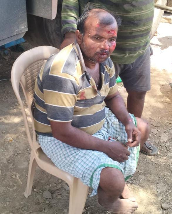 - విద్యార్థినికి గాయాలు